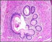 Fig 11