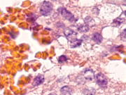 Fig 10