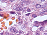 Fig 9